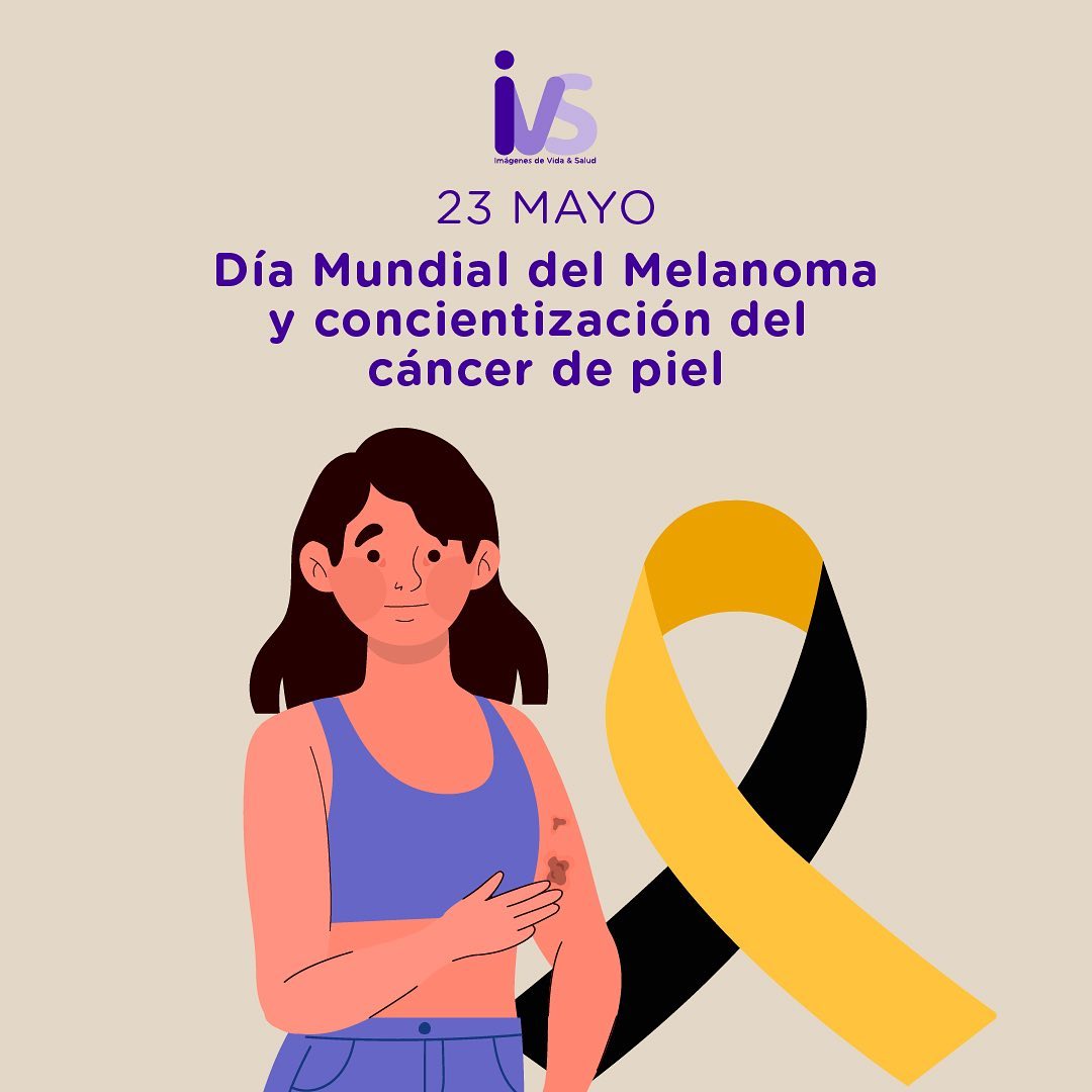 Día Mundial Del Melanoma Imágenes De Vida Y Salud